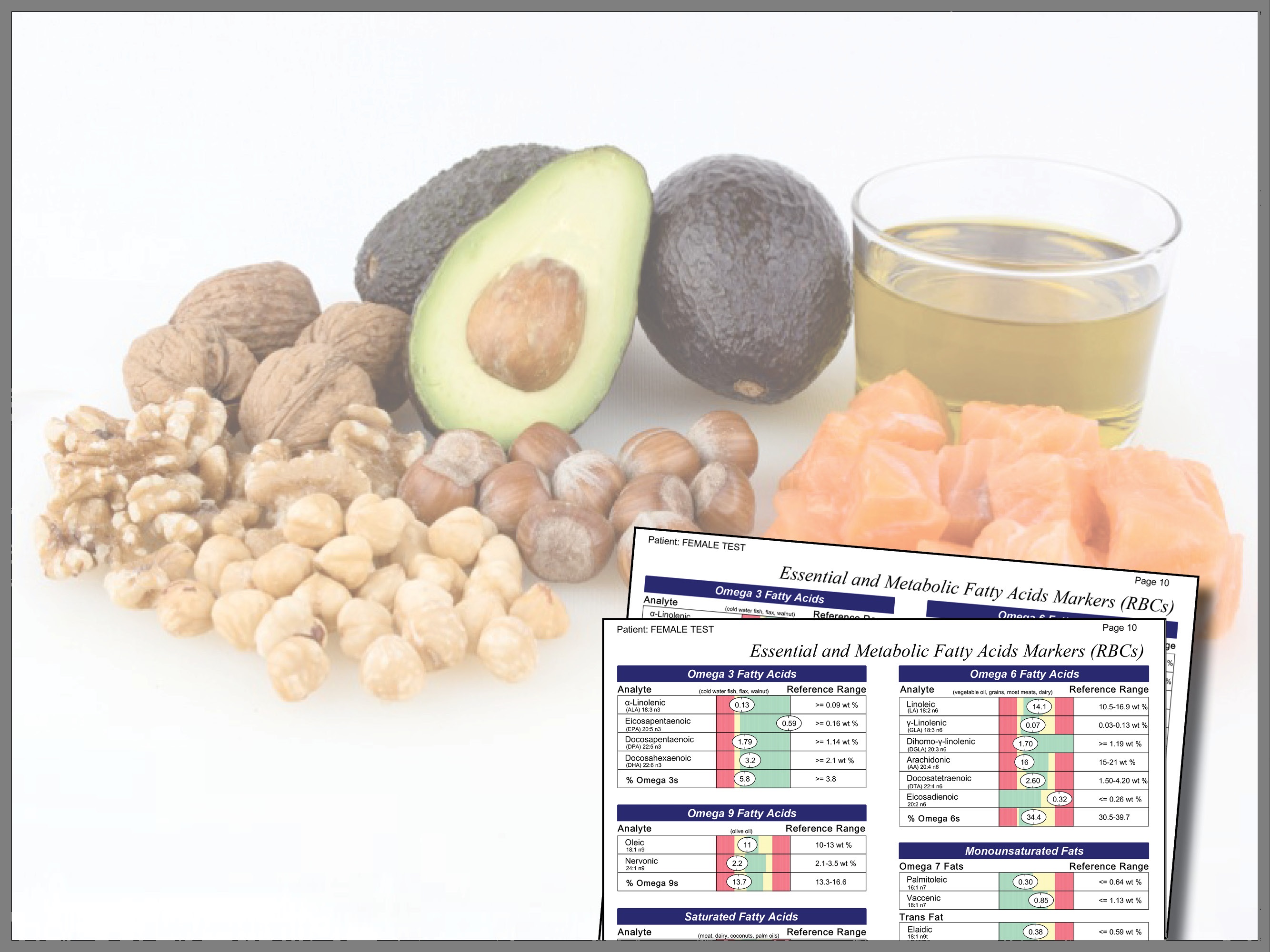 Nutritional Testing Overview Nutrition University Genova Diagnostics